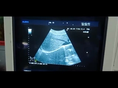 Der Ultraschallsonde Aloka UST-9130 Reihe UST-9130 konvexer Ultraschallwandler