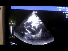 Mindray 2P2 teilte - Reihenultraschall-Wandlersonde für Herz-/pädiatrisches in Phasen ein